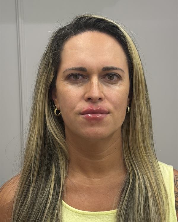 Mesma paciente de frente, logo após o procedimento